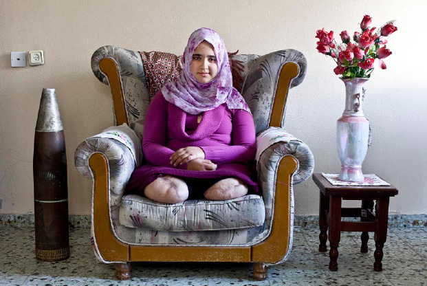 expo_gaza_jeune_fille_amputee-3.jpg