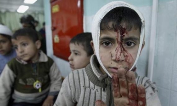 enfant_gaza_blesse_grand_format.jpg