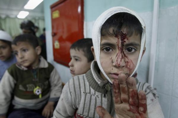 enfant_gaza_blesse_grand_format.jpg