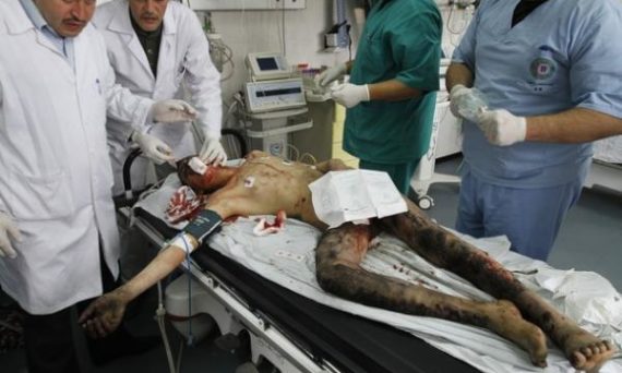 gaza_blesse_nu_hosto.jpg
