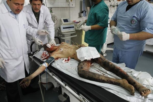 gaza_blesse_nu_hosto.jpg