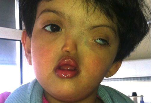 rahma_enfant_victime_du_phospore.jpg