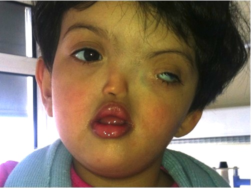 rahma_enfant_victime_du_phospore.jpg