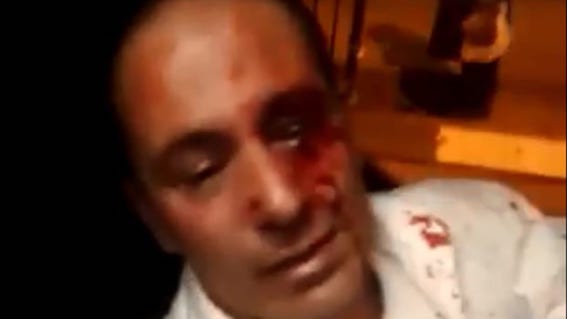 agression_chauffeur_bus_israel.jpg