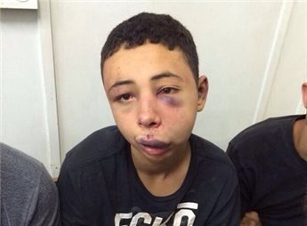 american-teenager-tariq-abu-khdeir.jpg