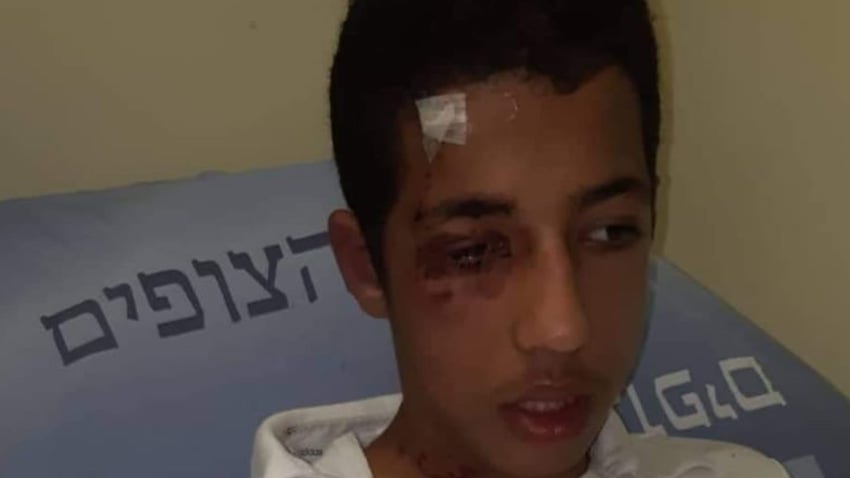 ibrahim_16_ans_attaque_par_jeunes_juifs.jpg