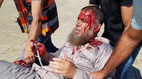 al_aqsa_fide_le_en_sang.jpg