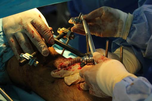 infections_chirurgie_gaza.jpg