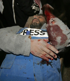 journaliste_palestinien_blesse_a_gaza.jpg