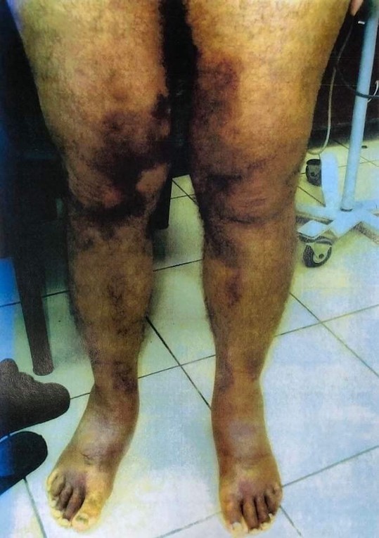 walid_torture_jambes.jpg