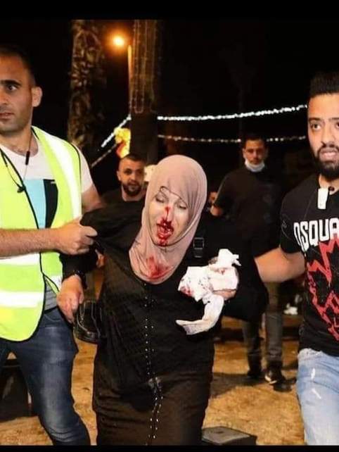 Encore plus de 60 blessés ce samedi soir à Jérusalem (Photos)