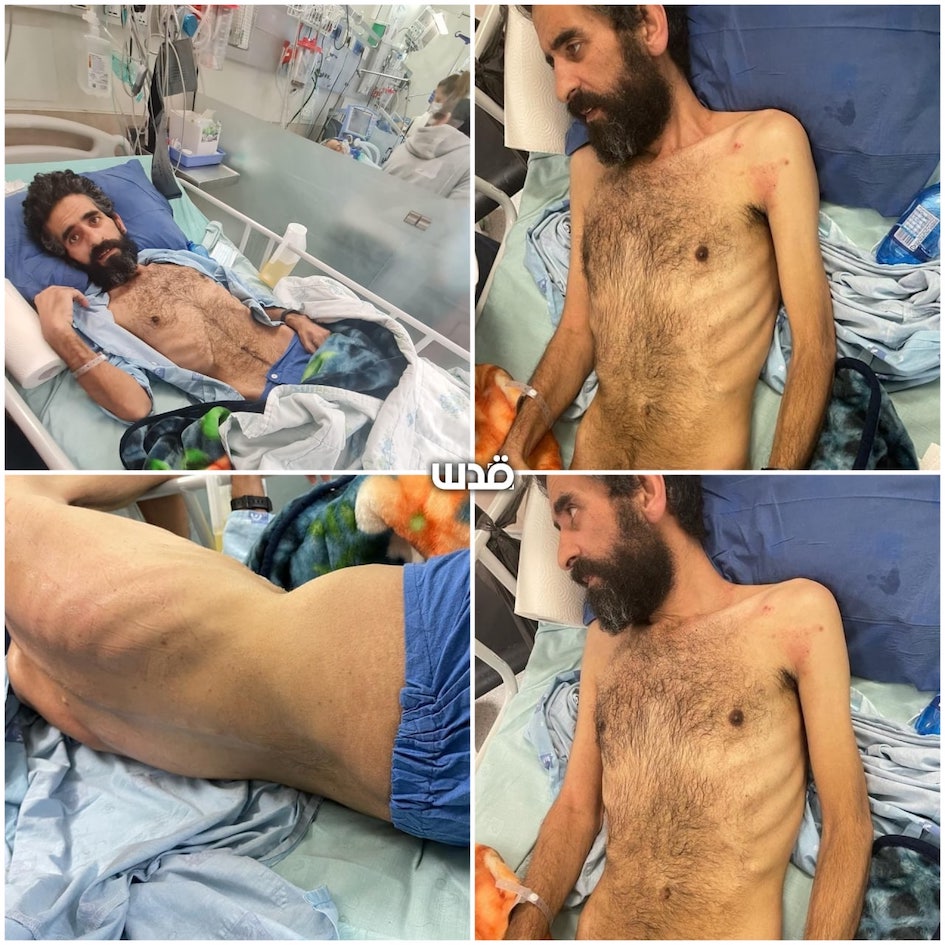 Abu Hawwash à 137 jours de grève de la faim : quelle honte !