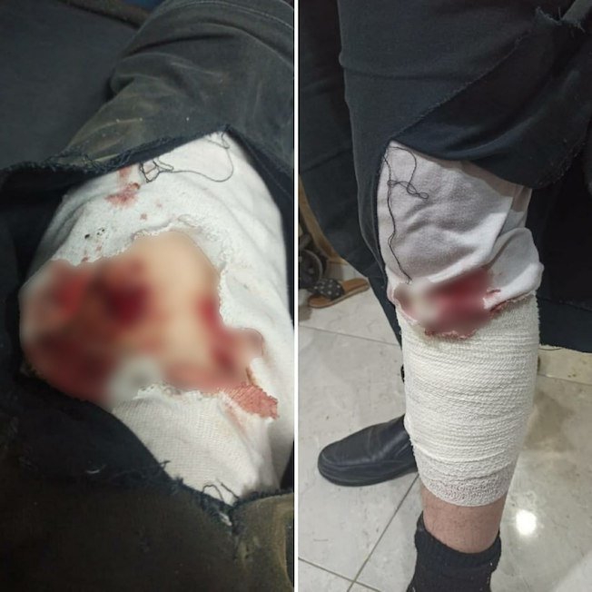 Terrorisme israélien : Chiens d'attaque, injections forcées, femmes déshabillées et battues...