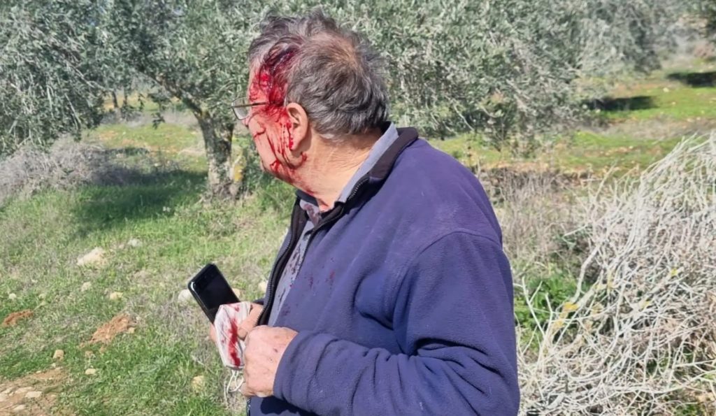 Les colons attaquent sauvagement des rabbins anti-occupation, avec la bénédiction de l’armée (photo, vidéo)