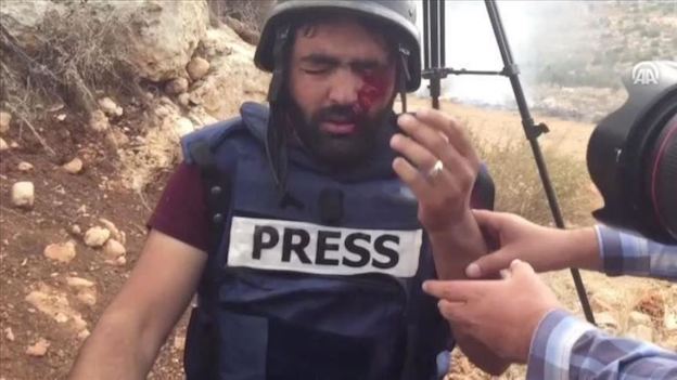 Et les journalistes palestiniens assassinés et blessés par Israël ? (Photos et vidéos)