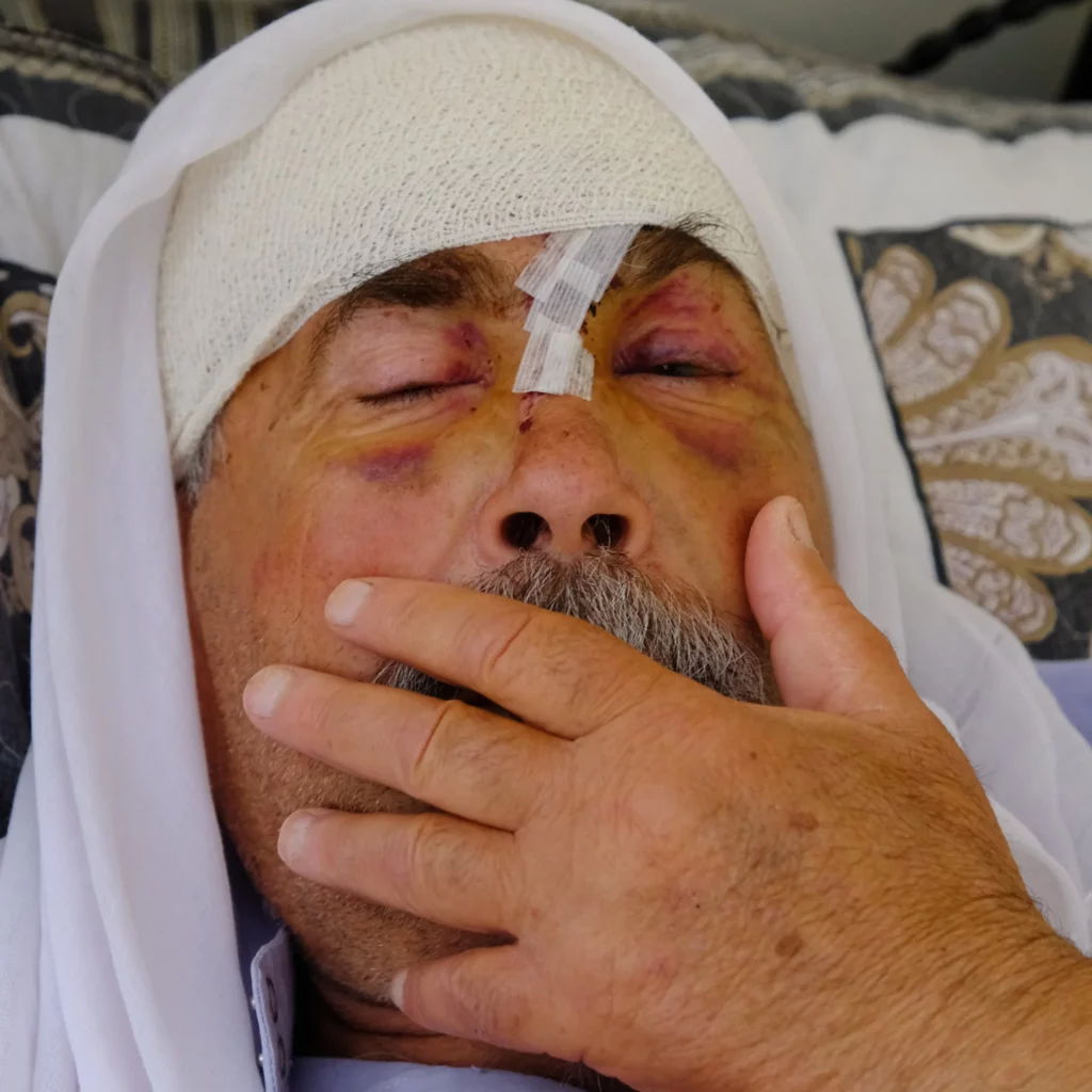 "Une famille palestinienne brutalement attaquée par des colons, avant d'être arrêtée par la police", par Gideon Levy