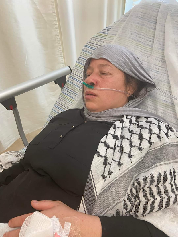 Incroyable mais vrai : nouveaux blessés à Nabi Saleh le jour de l'enterrement du petit Mohammed !