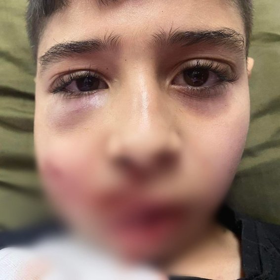 Qu'est-ce que nos dirigeants attendent pour armer la résistance palestinienne ?