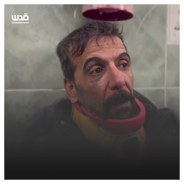 Les ravages causés par les tortures infligées aux Palestiniens de Gaza kidnappés (Vidéo)