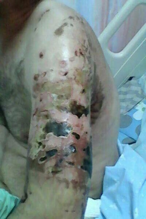 blessures_chien.jpg