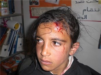 enfant_7_ans_attaque_e_par_colons.jpg