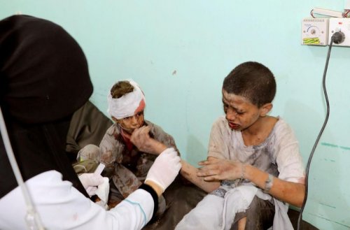 enfants_blesse_s_yemen_bus.jpg