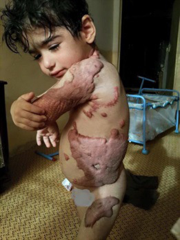 hamza_en_fant_gaza_brule_.jpg