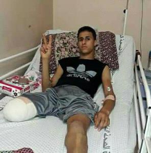 mahmoud_alhajwajri_20_ans_ampute_.jpg