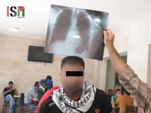 radiocancer_tulkarem.jpg