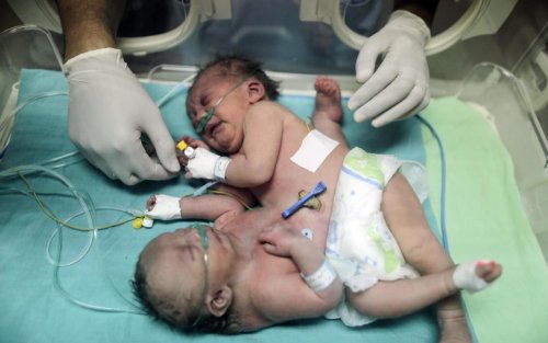 soeurs_siamoises_gaza.jpg