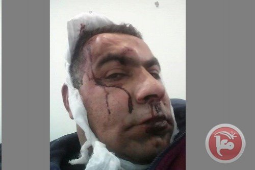 chauffeur_de_taxi_palestinien_agresse_par_colons.jpg