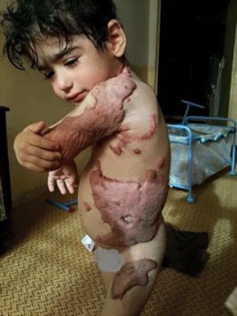 hamza_en_fant_gaza_brule_.jpg